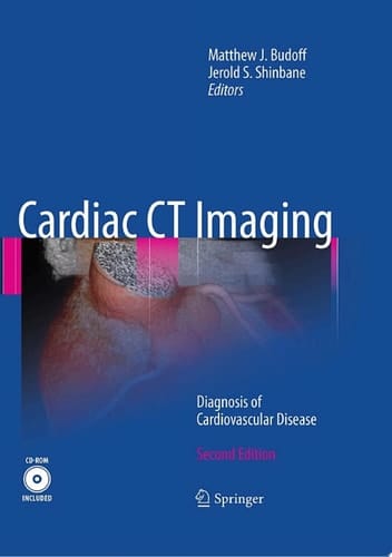 Cardiac CT Imaging