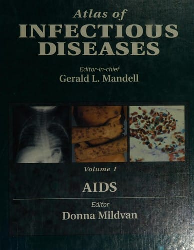 Atlas of Infectious Diseases: AIDS (Atlas of Infectious Diseases)
