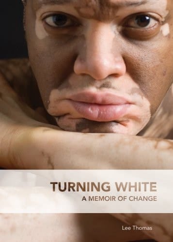 Turning White A Memoir of Change