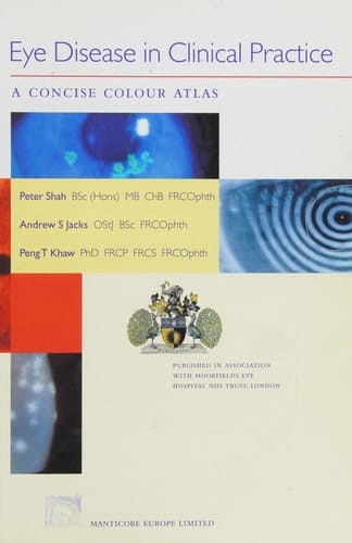 Eye Disease in Clinical Practice A Concise Colour Atlas