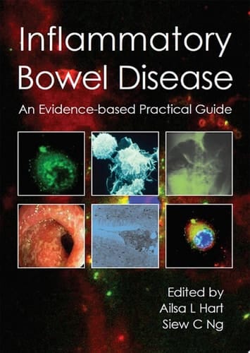 Inflammatory Bowel Disease an Evidence-based Practical Guide