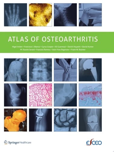 Atlas of Osteoarthritis