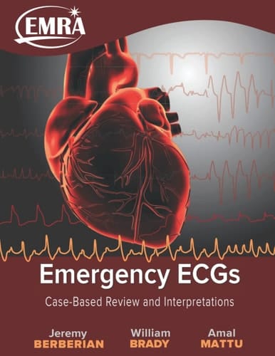 Emergency ECGs - Print Case-Based Review and Interpretations