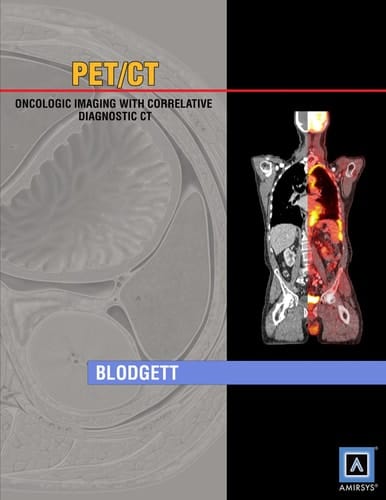 Specialty Imaging PET/CT oncologic imaging with correlative diagnostic CT