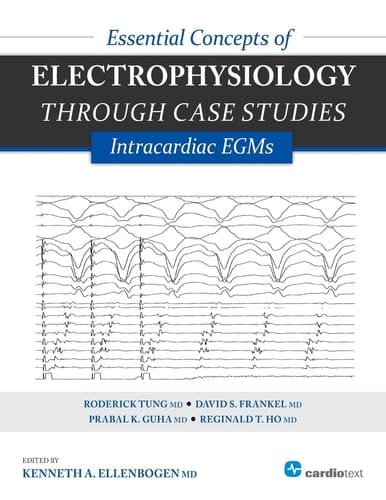 Essential Concepts of Electrophysiology Through Case Studies Intracardiac EGMs