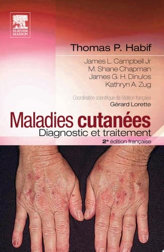 Maladies cutanées : diagnostic et traitement