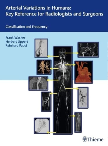 Arterial Variations in Humans Key Reference for Radiologists and Surgeons : Classification and Frequency