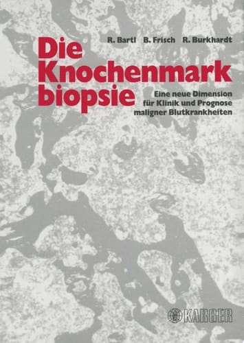 Die Knochenmarkbiopsie Eine neue Dimension für Klinik und Prognose maligner Blutkrankheiten