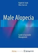 Male Alopecia Guide to Successful Management