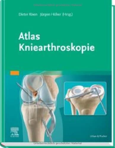 Atlas Kniearthroskopie