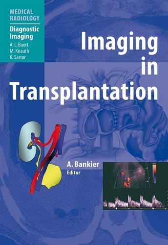 Imaging in Transplantation