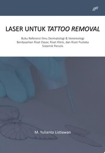 LASER UNTUK TATTOO REMOVAL
