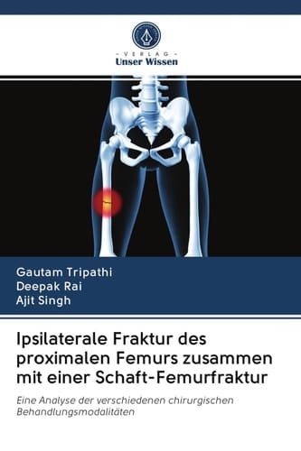 Ipsilaterale Fraktur des proximalen Femurs zusammen mit einer Schaft-Femurfraktur: Eine Analyse der verschiedenen chirurgischen Behandlungsmodalitäten (German Edition)