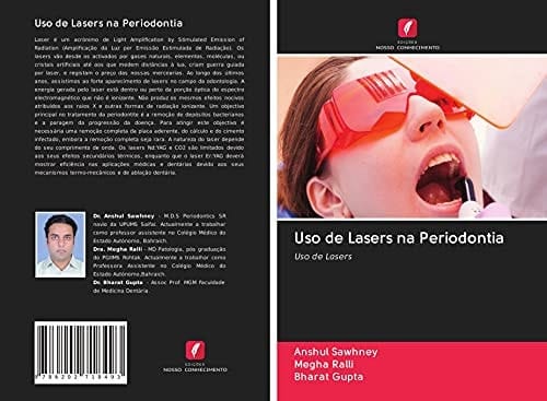 Uso de Lasers na Periodontia: Uso de Lasers (Portuguese Edition)