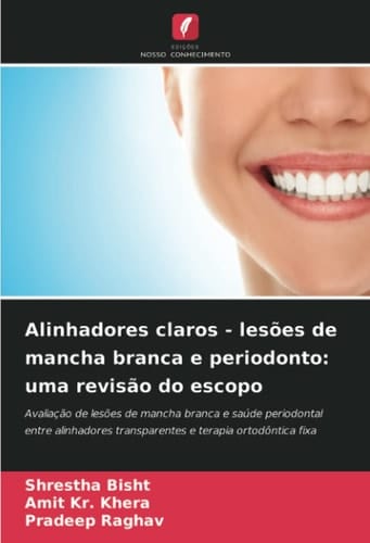 Alinhadores claros - lesões de mancha branca e periodonto: uma revisão do escopo: Avaliação de lesões de mancha branca e saúde periodontal entre ... terapia ortodôntica fixa (Portuguese Edition)