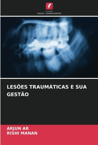 LESÕES TRAUMÁTICAS E SUA GESTÃO (Portuguese Edition)