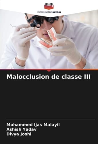 Malocclusion de classe III (French Edition)