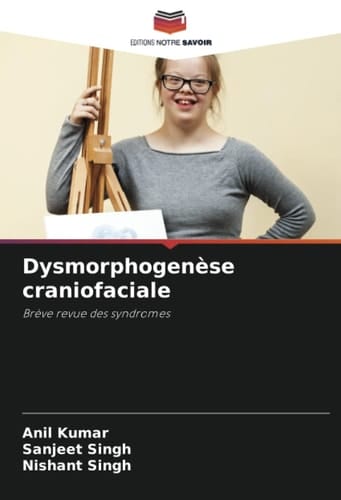 Dysmorphogenèse craniofaciale: Brève revue des syndromes (French Edition)