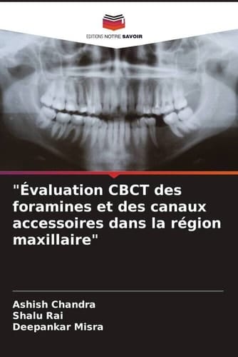 "Évaluation CBCT des foramines et des canaux accessoires dans la région maxillaire" (French Edition)