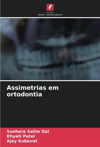 Assimetrias em ortodontia (Portuguese Edition)