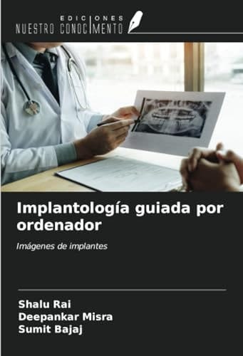 Implantología guiada por ordenador: Imágenes de implantes (Spanish Edition)