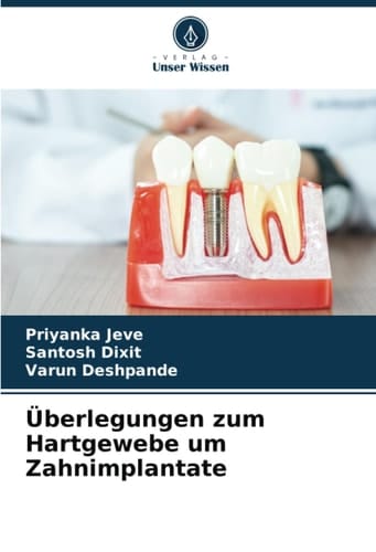 Überlegungen zum Hartgewebe um Zahnimplantate (German Edition)