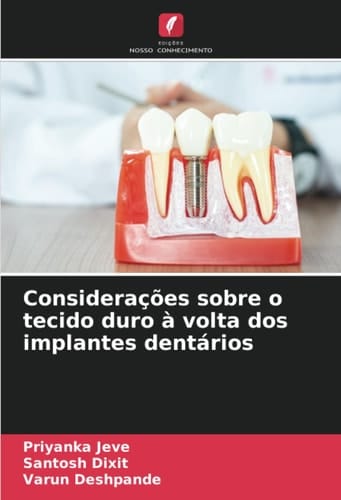 Considerações sobre o tecido duro à volta dos implantes dentários (Portuguese Edition)