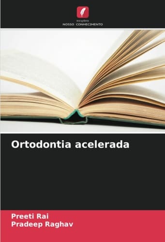 Ortodontia acelerada (Portuguese Edition)