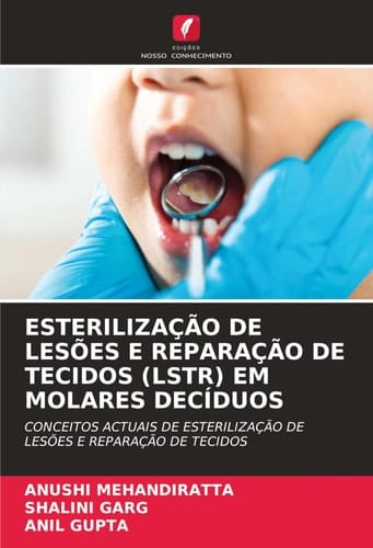 Esterilização de Lesões E Reparação de Tecidos (Lstr) Em Molares Decíduos (Portuguese Edition)