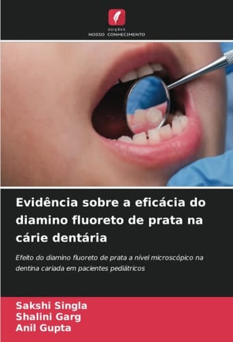 Evidência sobre a eficácia do diamino fluoreto de prata na cárie dentária: Efeito do diamino fluoreto de prata a nível microscópico na dentina cariada em pacientes pediátricos (Portuguese Edition)