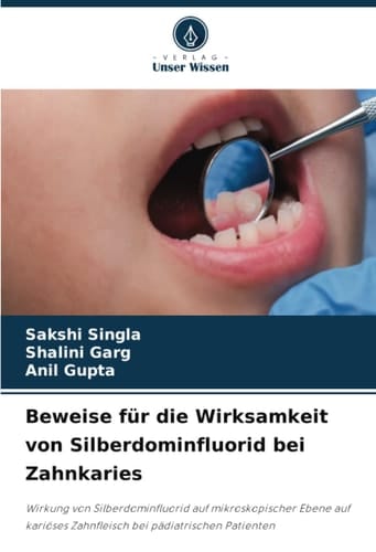 Beweise für die Wirksamkeit von Silberdominfluorid bei Zahnkaries: Wirkung von Silberdominfluorid auf mikroskopischer Ebene auf kariöses Zahnfleisch bei pädiatrischen Patienten (German Edition)