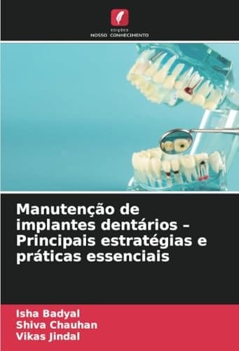 Manutenção de implantes dentários – Principais estratégias e práticas essenciais (Portuguese Edition)