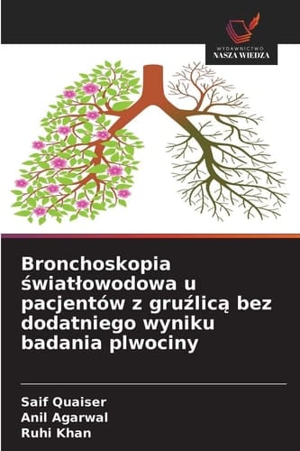 Bronchoskopia światlowodowa u pacjentów z gruźlicą bez dodatniego wyniku badania plwociny