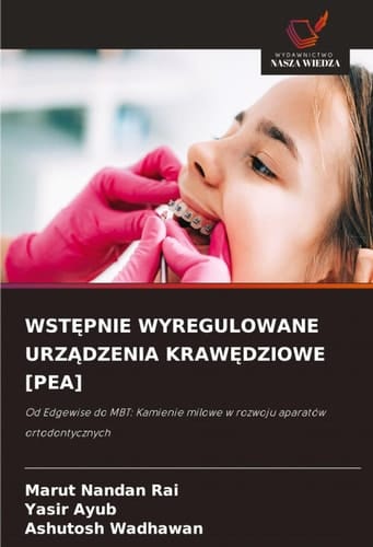 WstĘpnie Wyregulowane UrzĄdzenia KrawĘdziowe [Pea]
