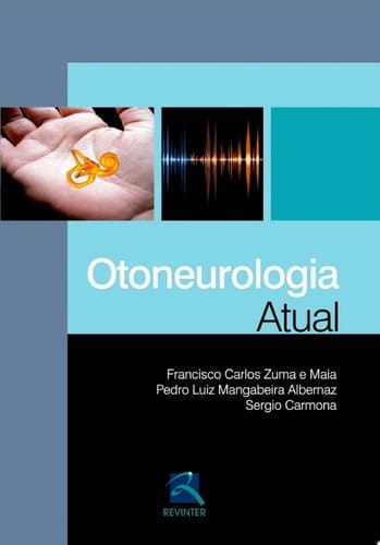 Otoneurologia Atual