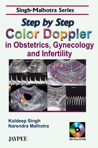 Step by Step Color Doppler in Obstetrics, Gynecology and Infertility with Photo CD-ROM by Singh