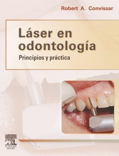 Láser en odontología - Principios y práctica