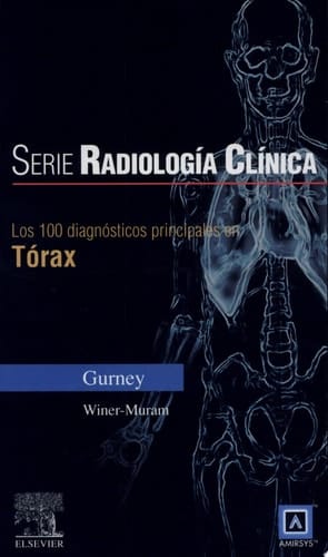 Los 100 Diagnósticos Principales en Tórax