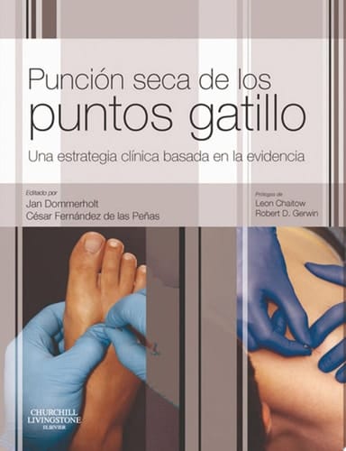 Punción seca de los puntos gatillo Una estrategia clínica basada en la evidencia