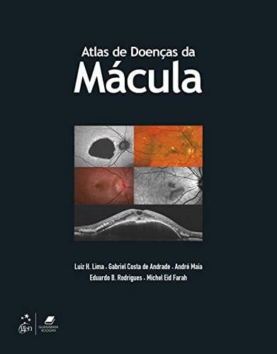Atlas de Doenças da Mácula