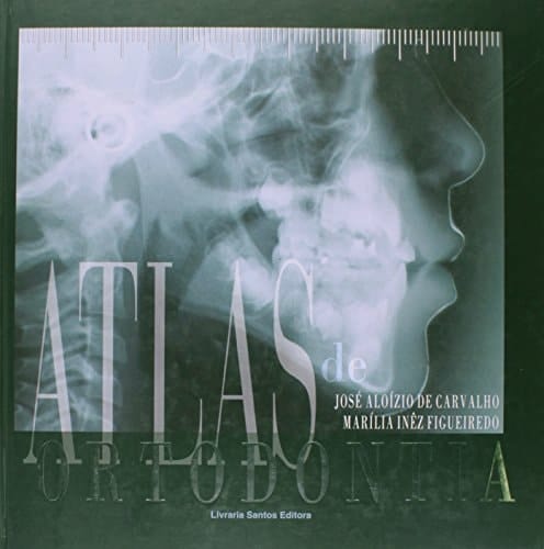 Atlas De Ortodontia