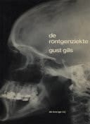 De röntgenziekte