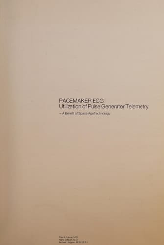Pacemaker ECG Utilization of Pulse Generator Telemetry-a Benefit of Space Age Technology