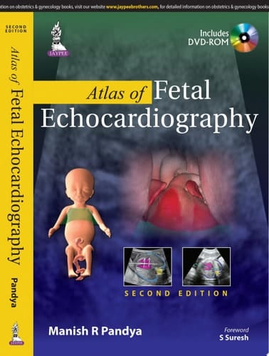 Atlas of Fetal Echocardiography