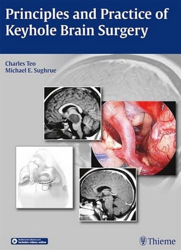 Principles and Practice of Keyhole Brain Surgery 1st Ed