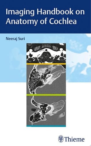 Imaging Handbook on Anatomy of Cochlea