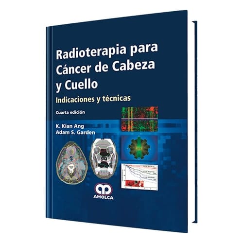 Radioterapia para cáncer de cabeza y cuello - indicaciones y técnicas