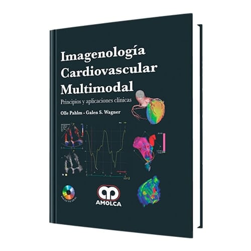 Imagenología cardiovascular multimodal. Principios y aplicaciones clínicas (Spanish Edition)