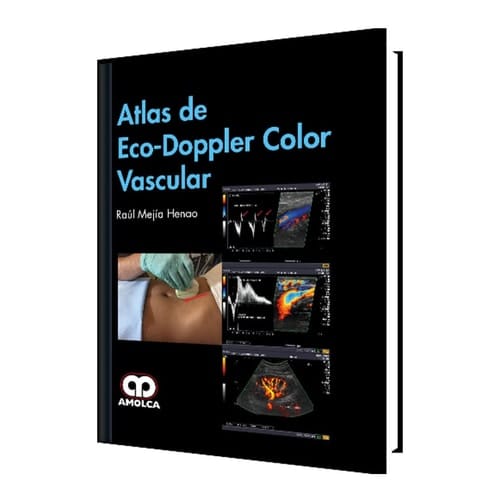 Atlas de Eco-Doppler Color Vascular (Spanish Edition)
