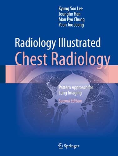 Radiology Illustrated: Chest Radiology Pattern Approach for Lung Imaging